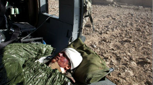 раненый солдат во сне