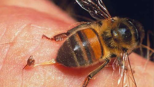 укус пчелы во сне