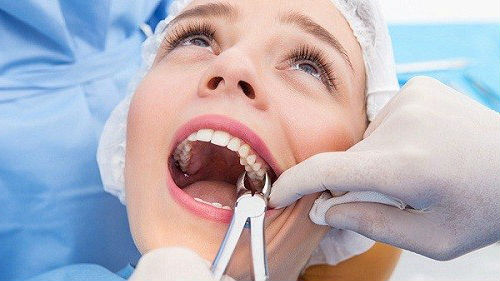 лечить зубы у стоматолога