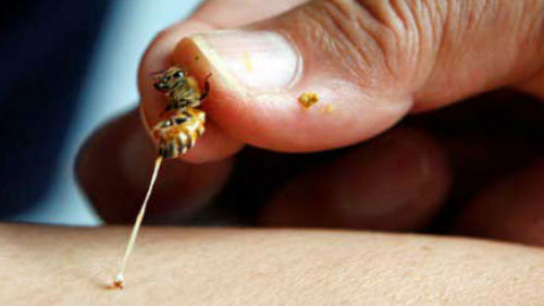 к чему снится укус пчелы в спину