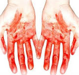 сонник кровь на руках