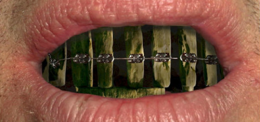 чёрные зубы