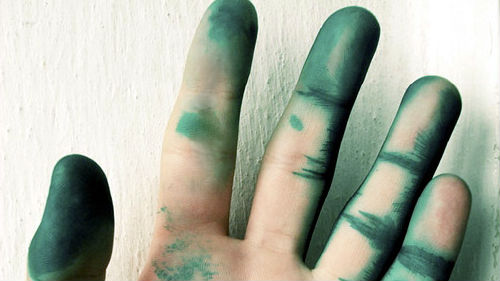 руки в зеленке