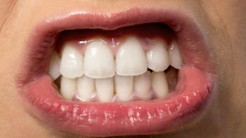 к чему снятся белые красивые зубы