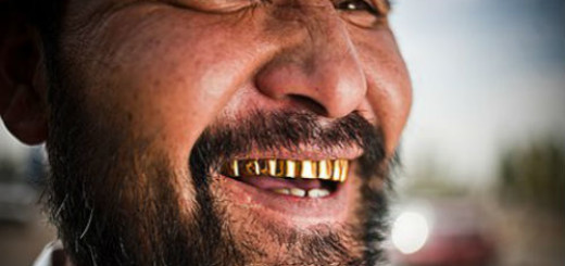 золотые зубы